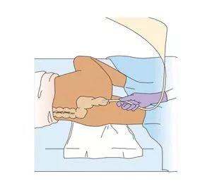 灌肠科普小知识,灌肠的各种知识点