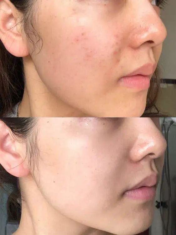 深扒明星美白抗衰秘籍!比防晒管用1000倍!4周逆袭成白皮,悄悄瘦掉8斤