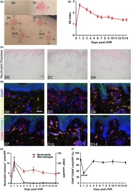被紫外线晒伤怎么修复颜色,紫外线晒伤后如何自愈