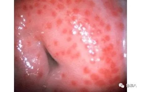 复习这些名解时总觉得怪饿的|协和八·脑洞大开