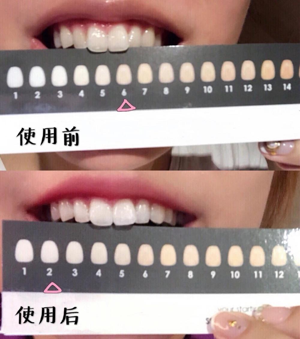 牙龈上火、红肿，还口臭？香港人用了91年的中药牙膏，消炎抑菌，让你刷出一口健康好牙