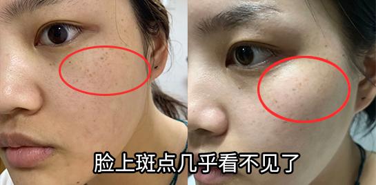 各类肌肤的实用美白技巧,美白牛奶肌的秘密在这里