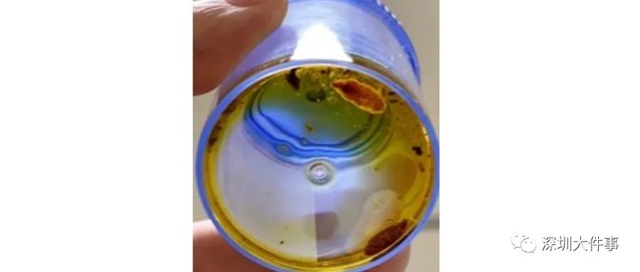 女人体内查出活虫只因一个菜,女子爱吃这道菜体内取出活虫