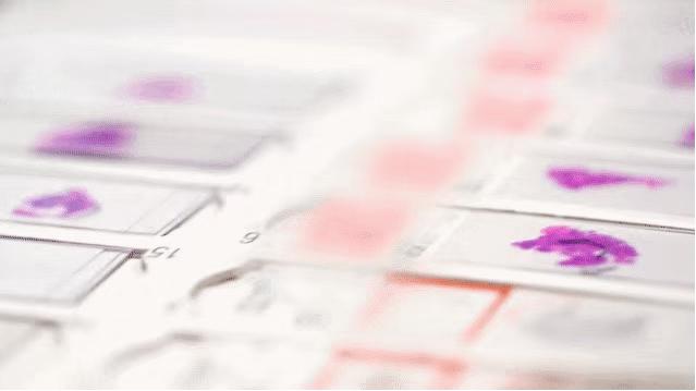 探秘病理科,病理科活检为什么慢