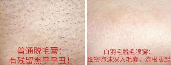 光滑无暇|黑丑的“毛裤腿”，用它，10分钟“脱”得一干二净，肌肤光滑细腻