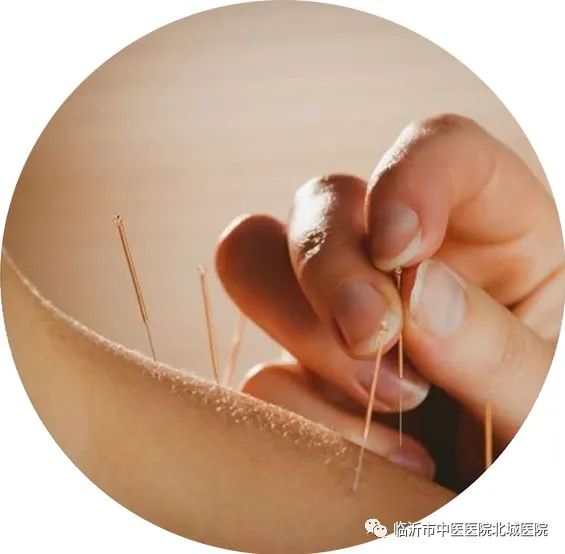 不用住院，医保报销！临沂这家医院的“中医日间病房”太赞了