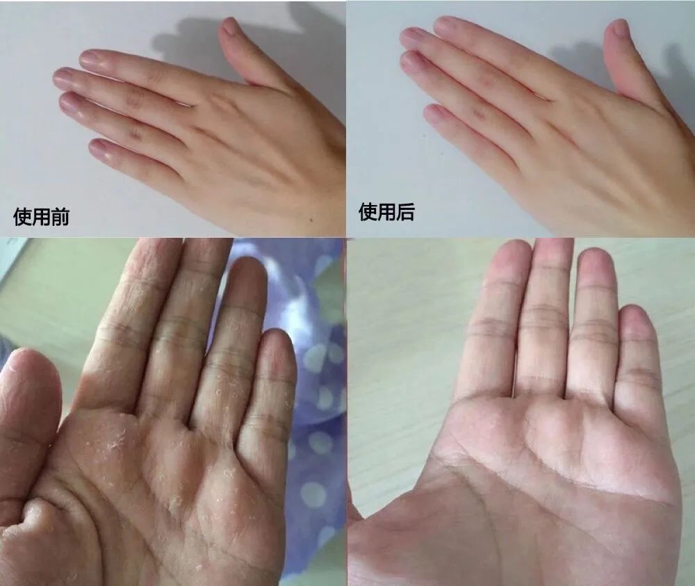 做家务手粗糙怎么办,干家务多用什么护手霜