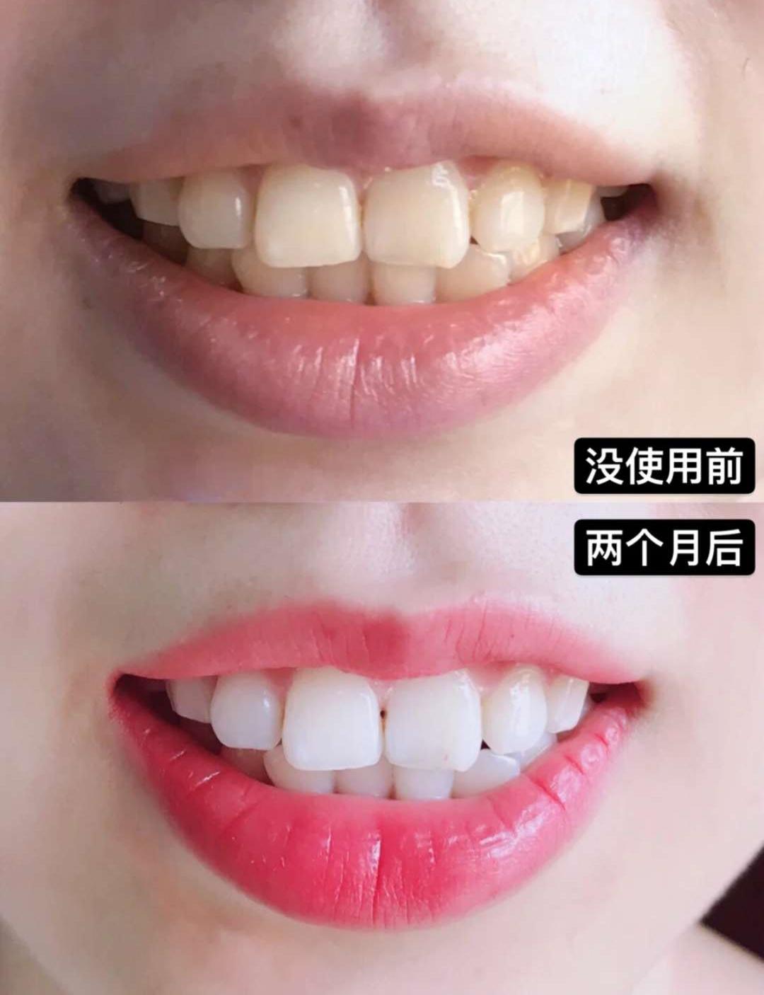 牙龈上火、红肿，还口臭？香港人用了91年的中药牙膏，消炎抑菌，让你刷出一口健康好牙