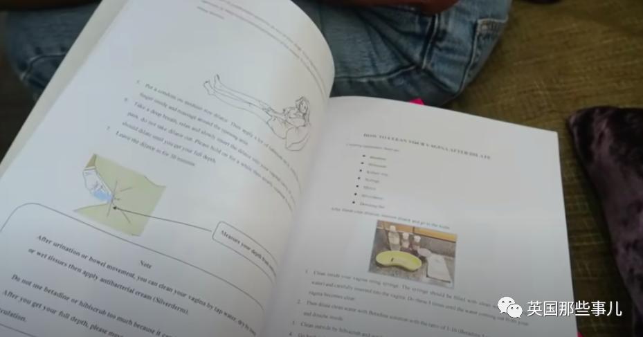 做变性手术的所有过程,变性手术全过程