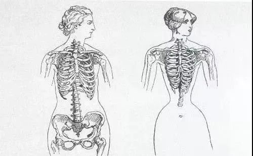 「网红束腰」：全世界有3亿人，在悄悄花钱买死