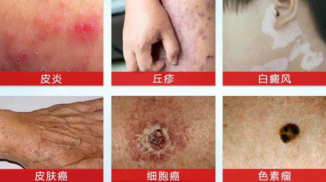 泰国人用什么防晒,泰国人参防晒