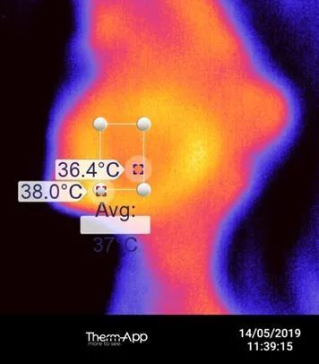 法令纹怎么办,脸上长皱纹怎么办