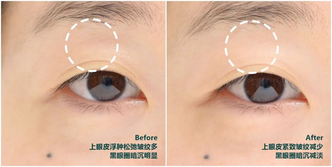 推广｜|啊啊啊，这些经常回购的东西终于打折了