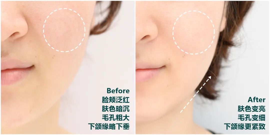 推广｜|啊啊啊，这些经常回购的东西终于打折了