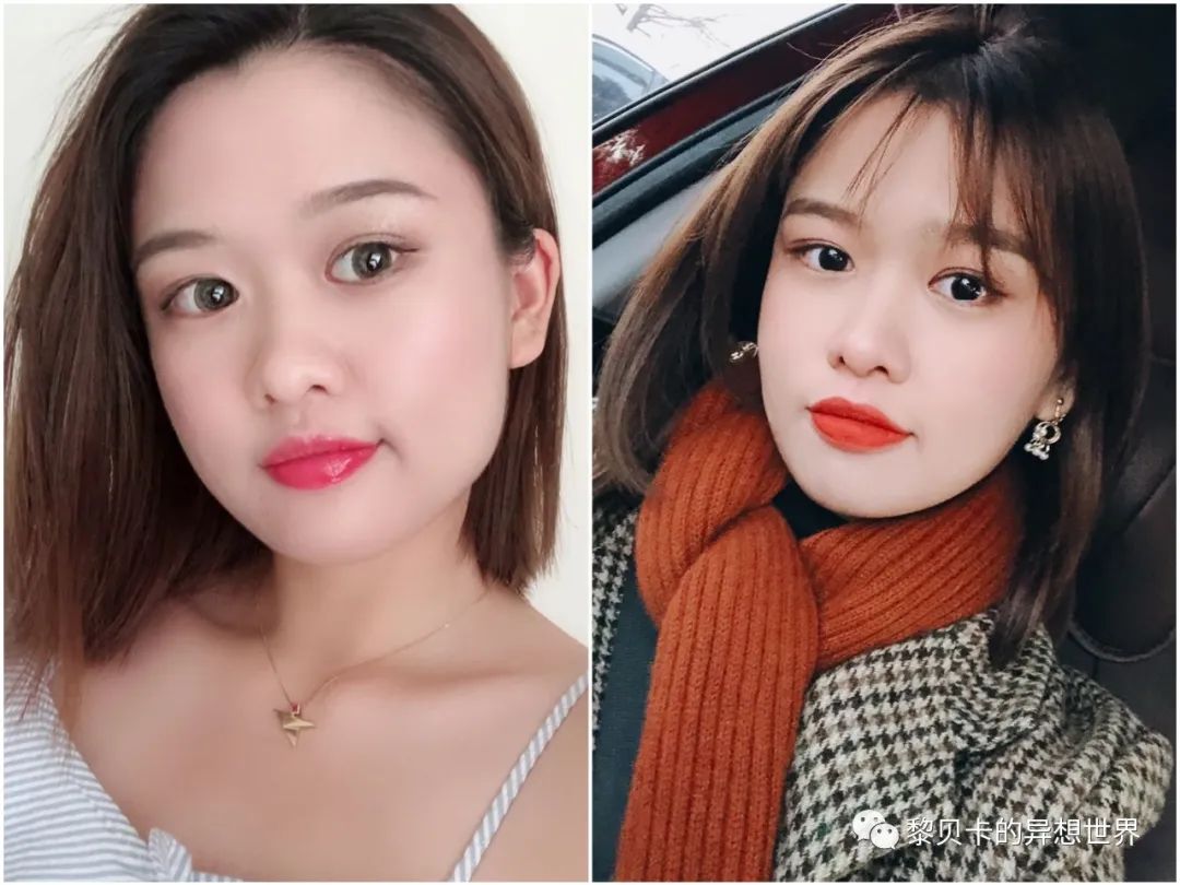 做完医美真的能换脸吗,做完医美需要注意什么