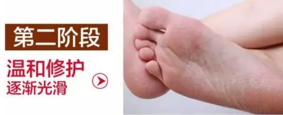 脚臭脱鞋多久可以去味,脚臭喷鞋袜除臭