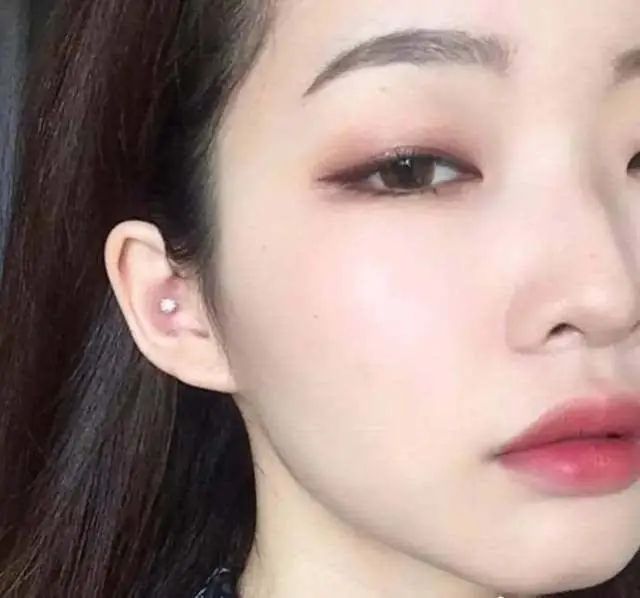 变双眼皮半个月后回到单眼皮,双眼皮怎么临时变成单眼皮