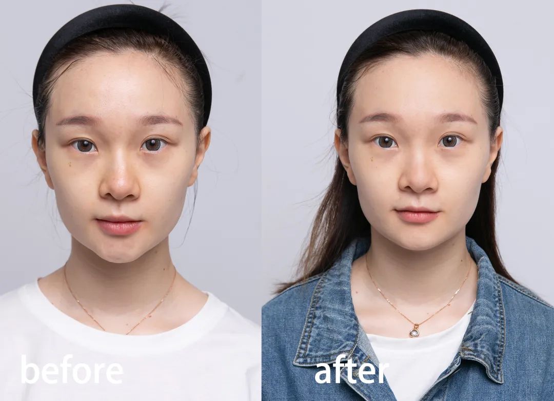 黄金美容最好的方法,黄金美容靠谱吗