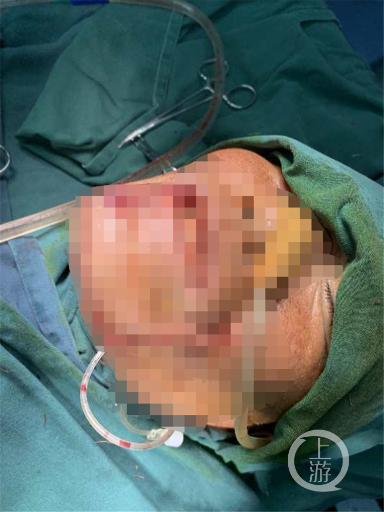 中国男子用牙齿咬电线被电身亡,牙齿咬电线触电