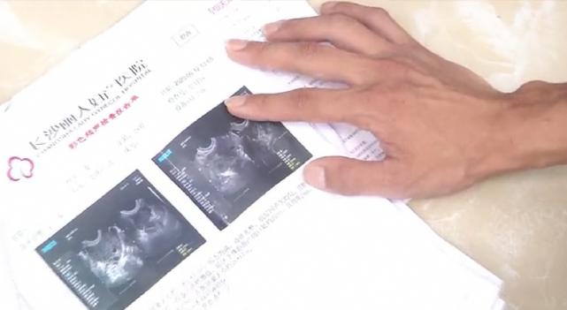 女子做流产手术30分钟,女子做无痛人流手术