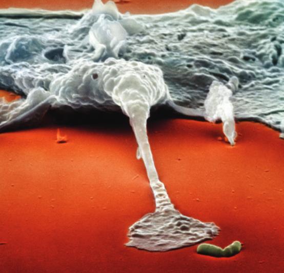 人人学懂免疫学第一期,人人学懂免疫学5期