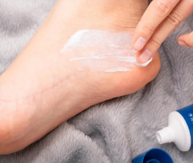 一招告别死皮老茧脚,去脚后跟老茧死皮的法子