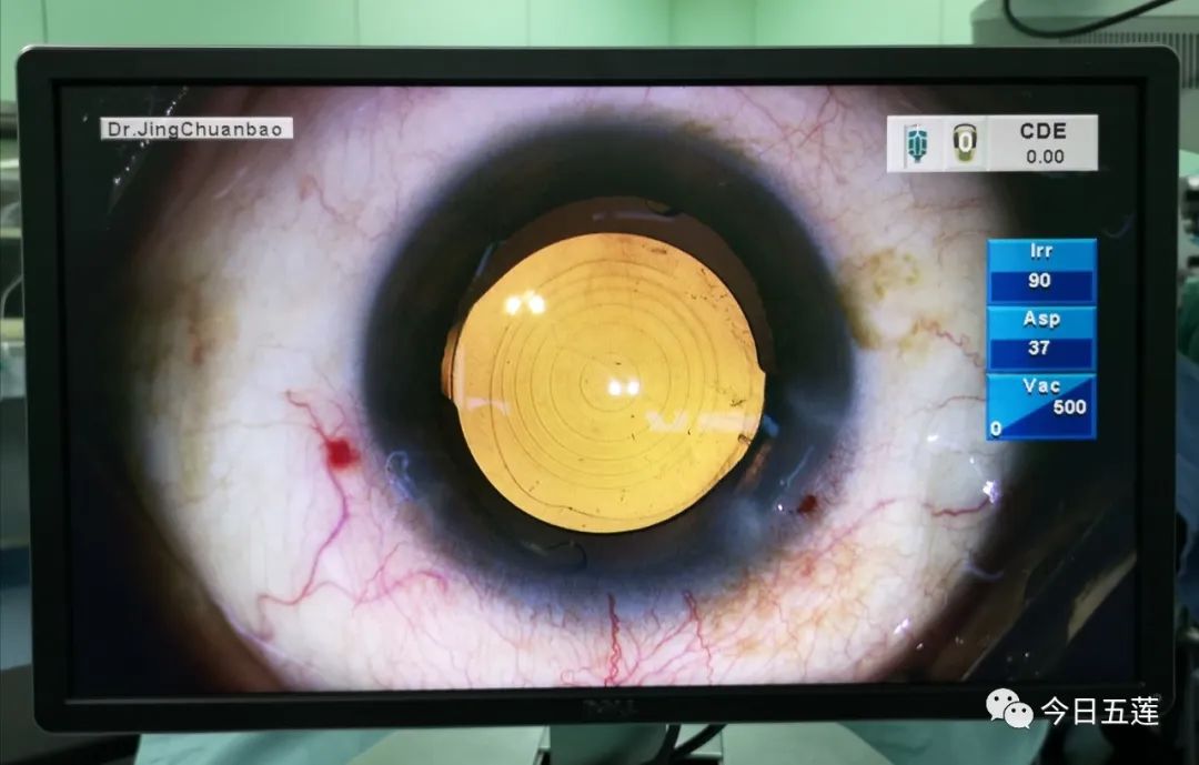 日照市中医医院新项目,五莲中医医院眼科