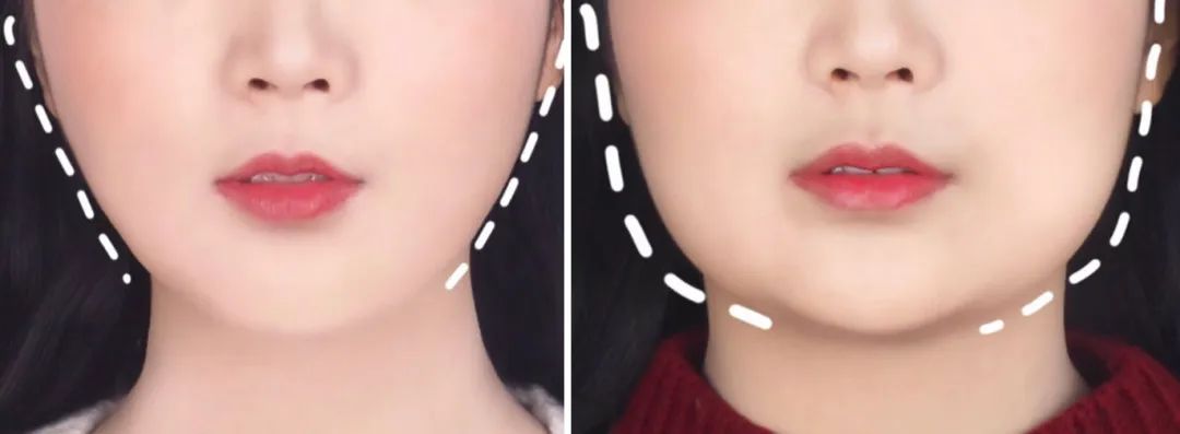 女明星祛口臭的偏方,明星用的口气清新剂