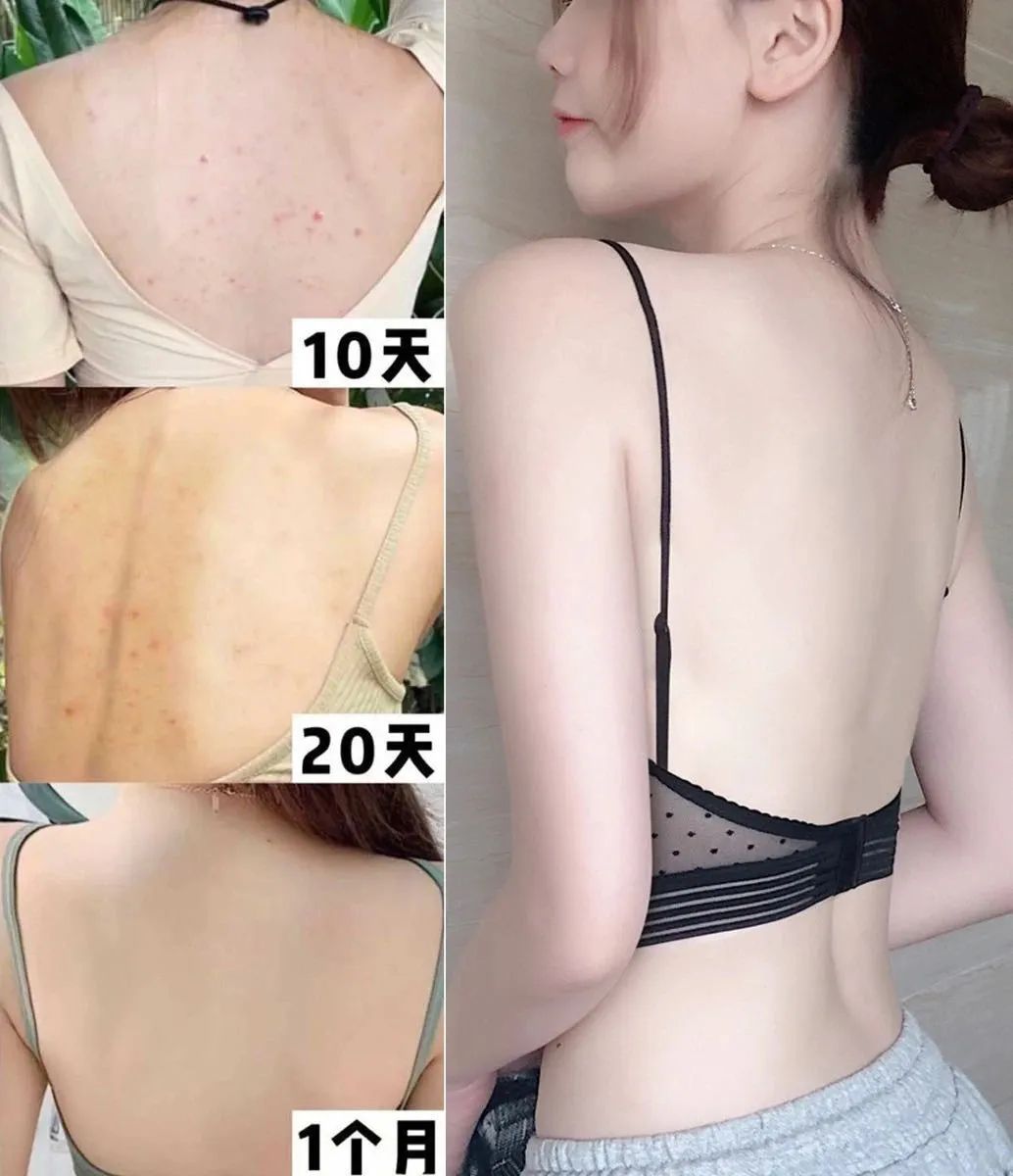 老是感觉身上痒痒的是螨虫吗,总觉得身上痒有虫子爬怎么回事