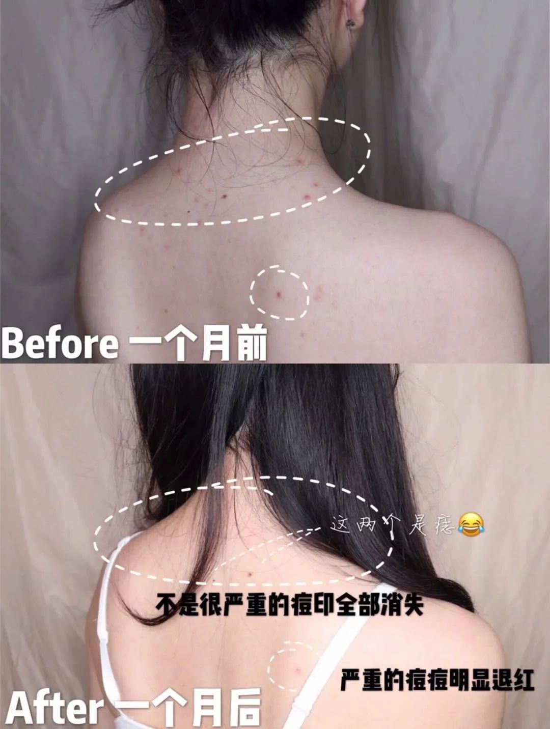 老是感觉身上痒痒的是螨虫吗,总觉得身上痒有虫子爬怎么回事