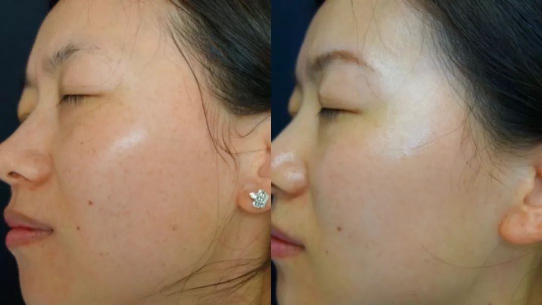 9个最简单有效的美白方法,6个最有效的美白方式你造吗