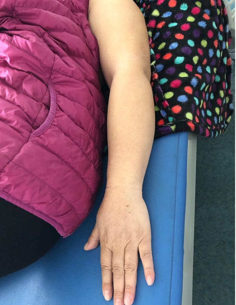 cdt娌荤枟,cdt娌荤枟缂虹偣