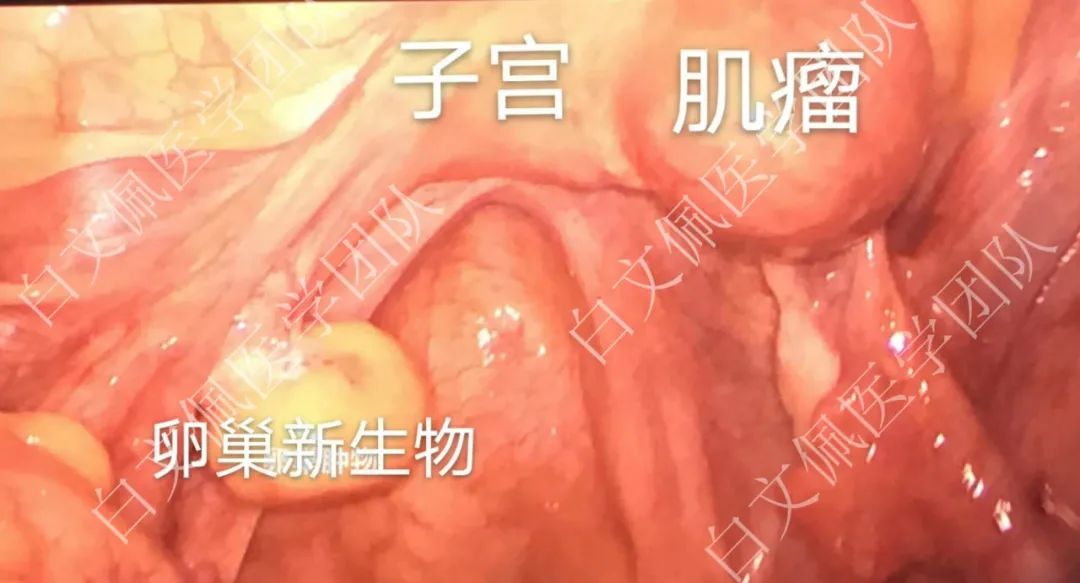 全彩人体解剖学图谱第二版,盆腔解剖学彩图教学视频