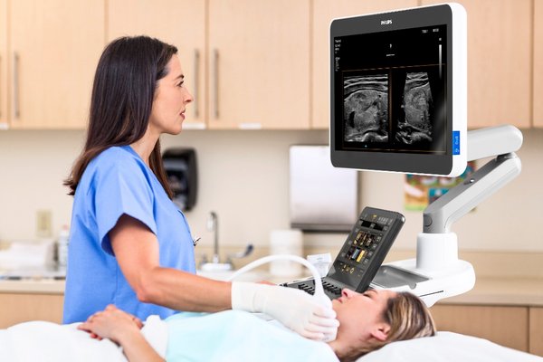 飞利浦的什么产品最好用,飞利浦epiq5高端智能超声诊断系统