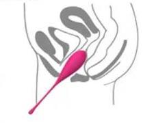 生完小孩会有的后遗症图片,生完孩子后会存在哪些危险