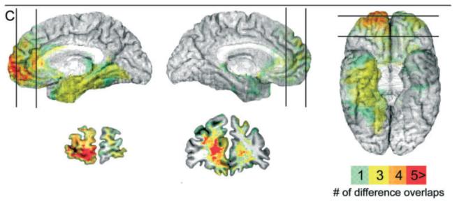 囤物癖和断舍离,囤货癖