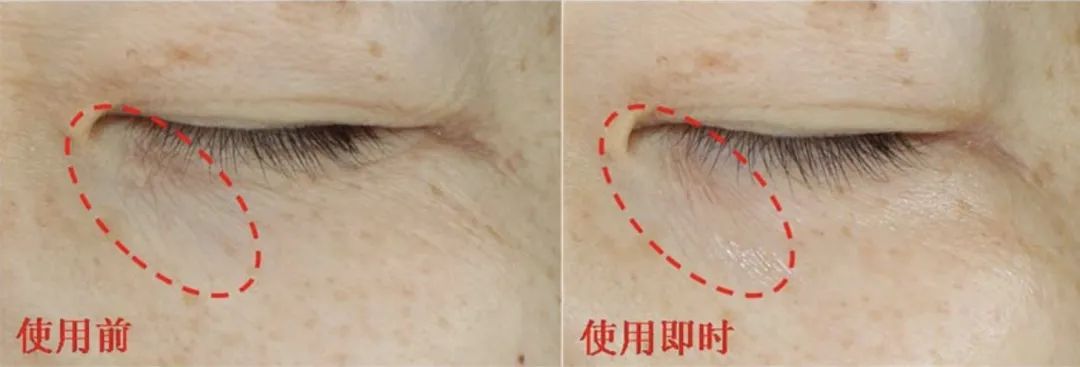 用空瓶回购眼霜,值得空瓶回购的眼霜