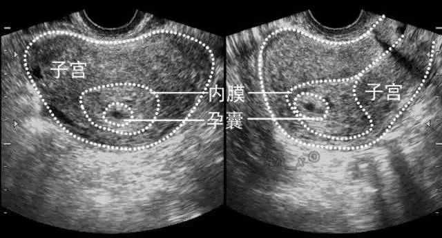 健康一点通怎么查看体检报告,健康孕检单视频