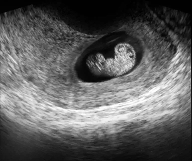 怎样读懂多普勒超声报告单,健康监测体检报告单