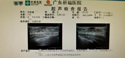 1岁宝宝左乳凸起,1岁宝宝乳核发育怎么回事