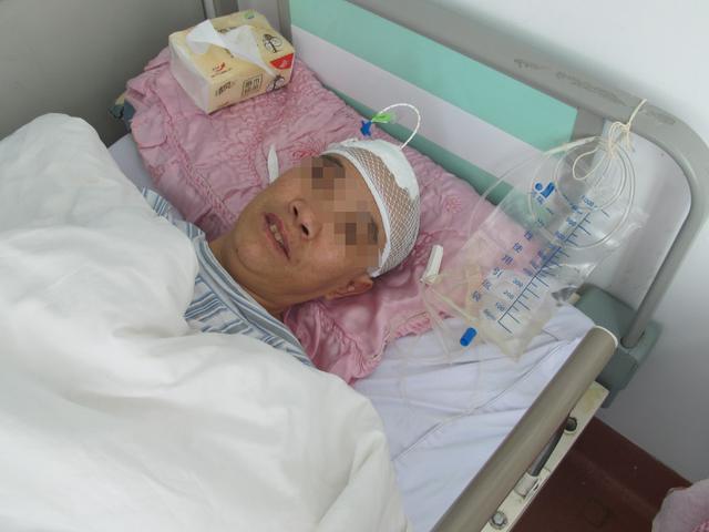 脑积水腹腔分流术后头晕头痛,脑积水分流术后发烧会有什么后果