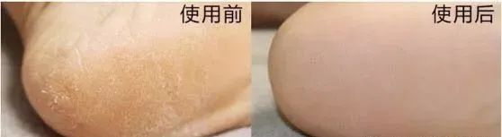 莉碧儿玻尿酸晶萃保湿面膜,莉碧儿水润保湿面膜怎么样