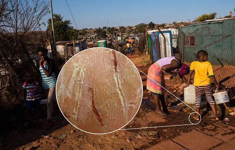 你穿高跟鞋经历过磨脚的痛苦吗,穿高跟鞋脚掌死皮怎么去除