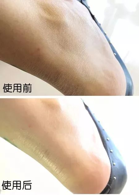 李佳琦赞不绝口的全能乳膏，一年卖出600万瓶，秋冬有它，皮肤再也不干燥