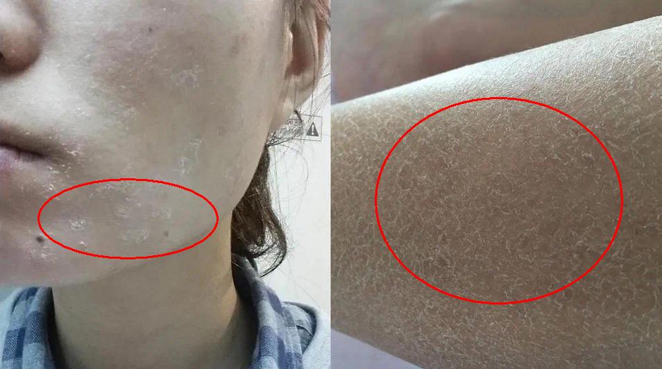 华山医院身体乳推荐,华山医院身体乳