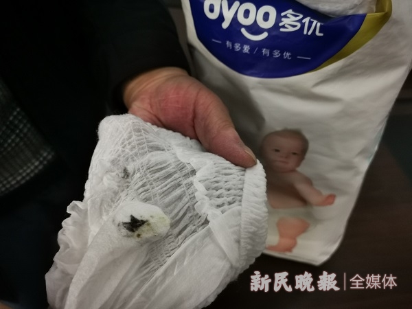 儿童纸尿裤里出血迹,宝宝纸尿裤上有红色血迹