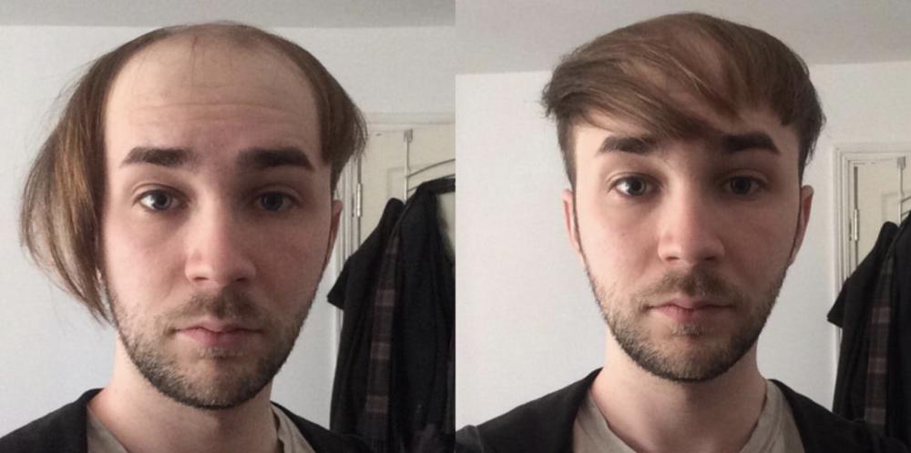 没有头发的人是不是很傻,没有头发的人生活怎么样