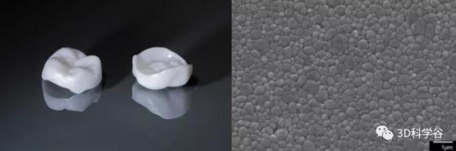 3D打印陶瓷牙冠可靠吗?请参考来自上海与欧洲口腔科研机构的研究