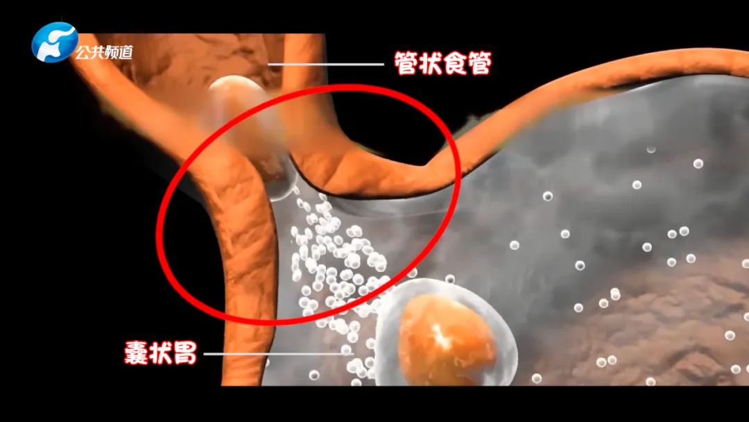 节目预告|河南广播电视台公共频道《健康同行》栏目第344期节目播出通知单