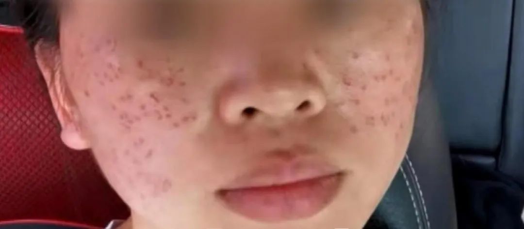 女子洗把脸花了8000多,女子洗把脸花了8000元